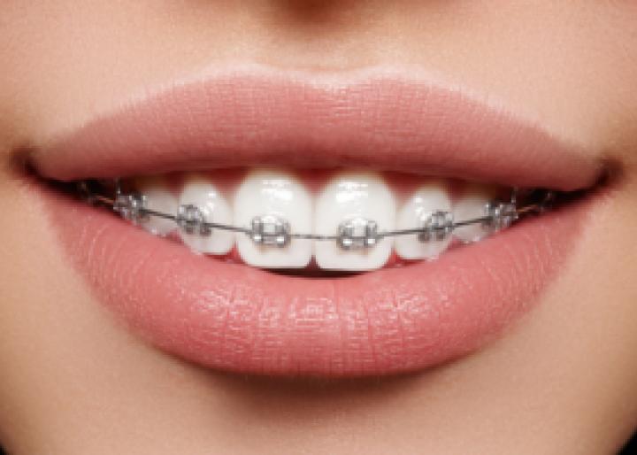 Dental Beldent Point