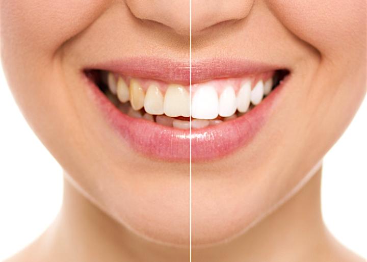 DENTAL BENEFIT