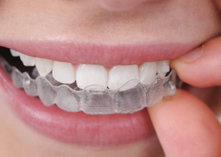 Pianeta Sorriso